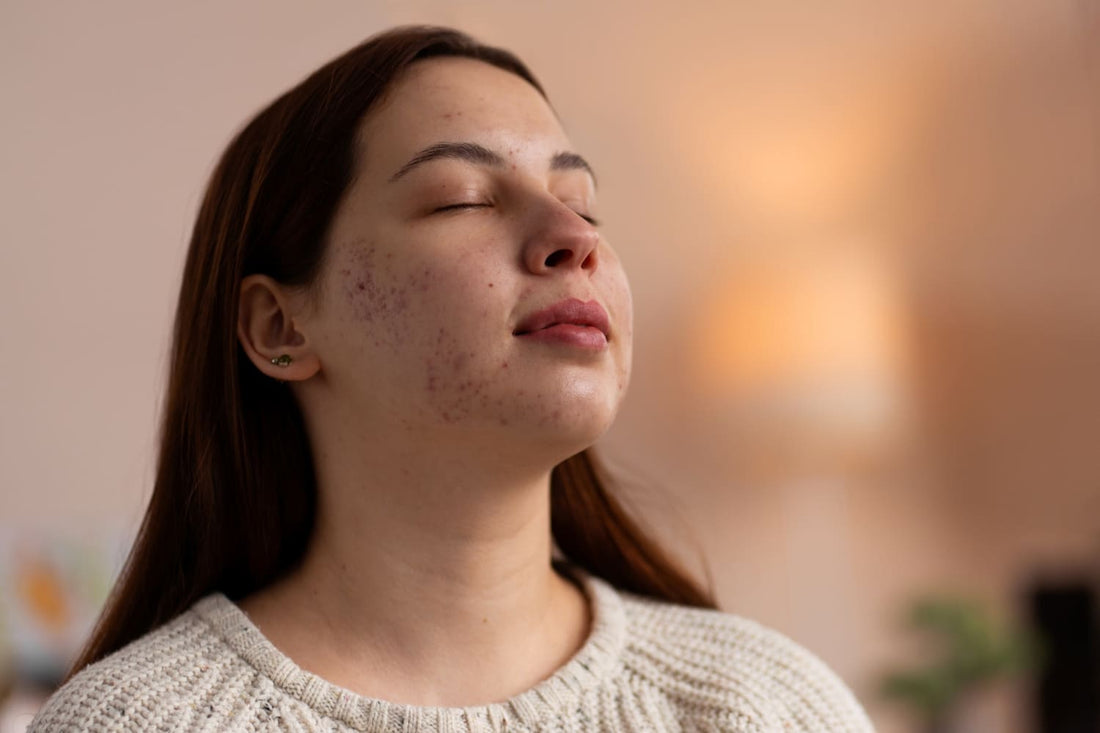 Fading Dark Spots: The Science Behind a Brighter, Even Complexion
